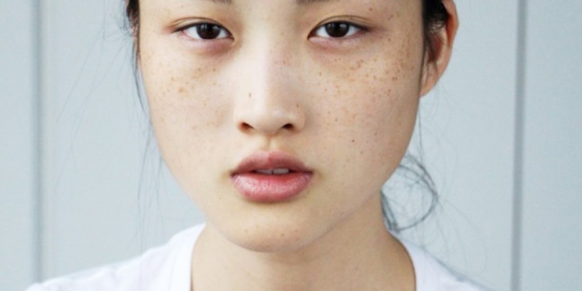 Сепкилдин пайда болуу себептери жана үй шартында арылуу жолдору