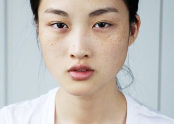 Сепкилдин пайда болуу себептери жана үй шартында арылуу жолдору