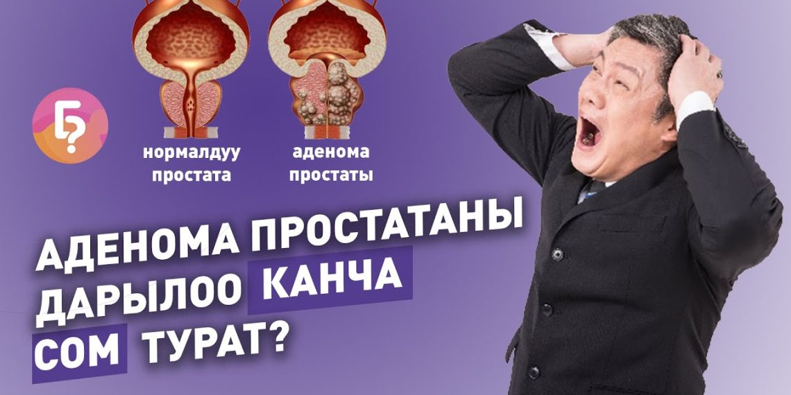 Простата аденомасы деген эмне жана аны кантип дарыласа болот?