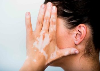 Жигитим ала оорусу менен ооруганымды билип таштап кетти. Эмне кылам?