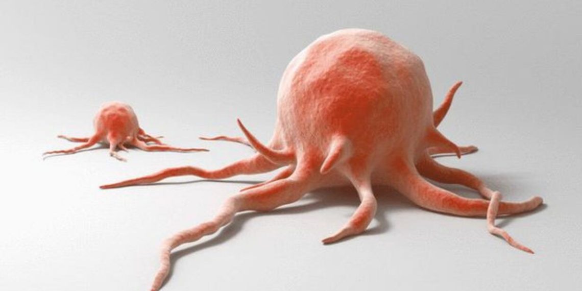 #КЫСКА_НУСКА: Учурда онкологиялык оорулар менен ооруган жаш балдар көппү?