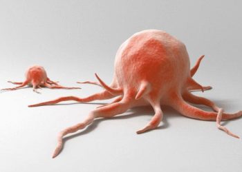 #КЫСКА_НУСКА: Учурда онкологиялык оорулар менен ооруган жаш балдар көппү?