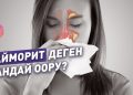 Гайморитти кантип дарыласа болот? Дарыгер-лордун жообу