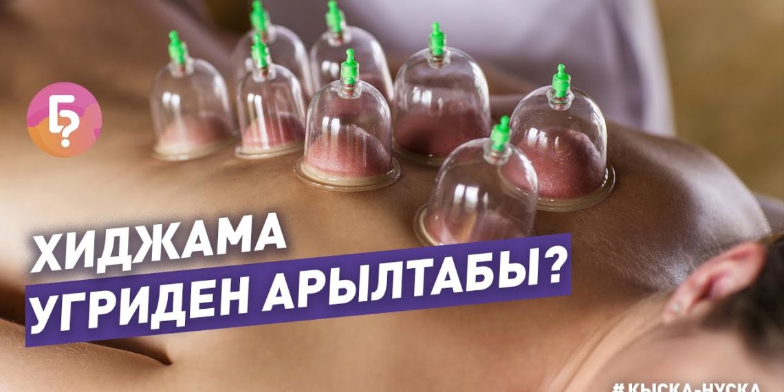 #КЫСКА_НУСКА: Угрини хиджама менен кетирсе болобу? Дерматокосметолог жооп берет