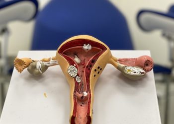 Жатын эрозиясын күйгүзбөй эле дарыласа болобу? Гинеколог айтып берет