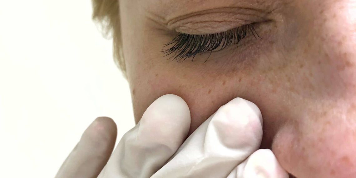 Гаймориттин пайда болуу жана алдын алуу жолдору