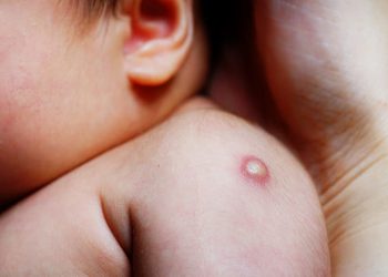 Балдарды кургак учуктан сактоо үчүн жасалган БЦЖ эмдөөсү тууралуу 8 факт