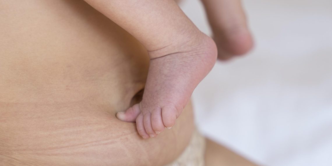 Төрөттөн кийин жыныс кынын кантип кичирейтсе болот?