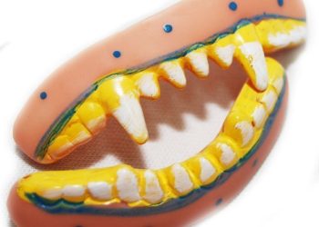 Тиш бул 5 себептин айынан улам саргарып кетет