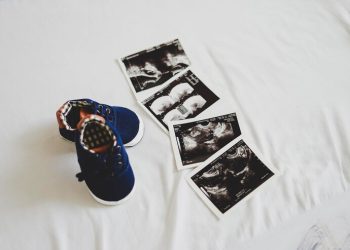 18 жумалык боюмда бар