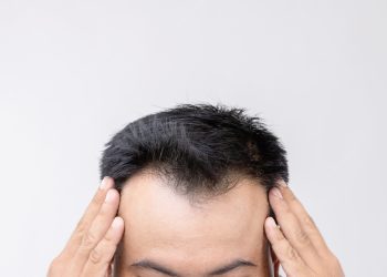 Шапка көп кийсең маңдайыңдагы чач түшө баштайбы? Трихолог жооп берет