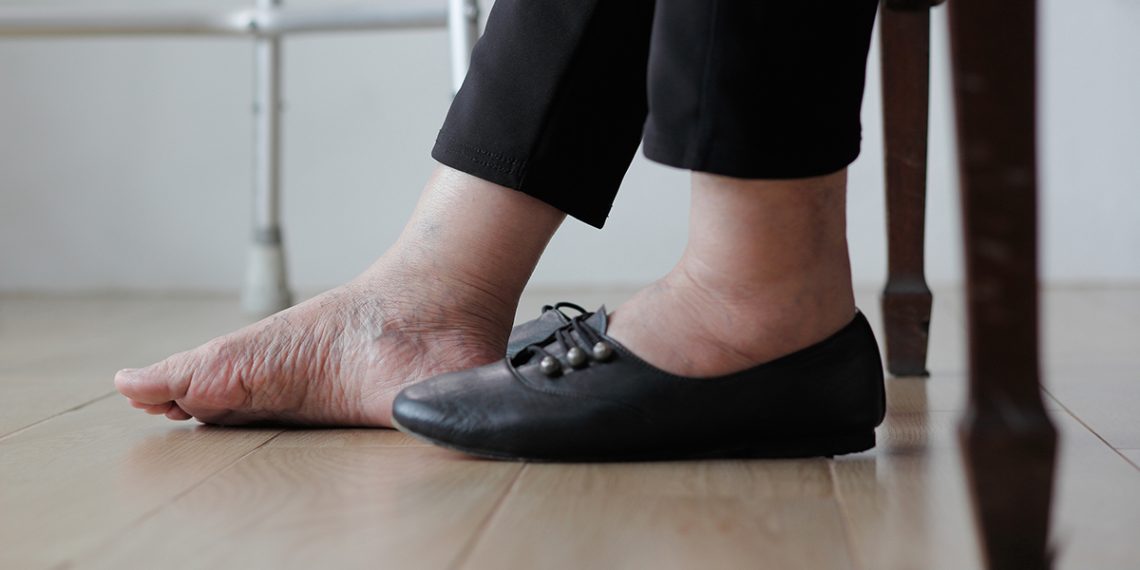 Эмнеге эртең менен турсаңыз шишип каласыз? 4 себеп