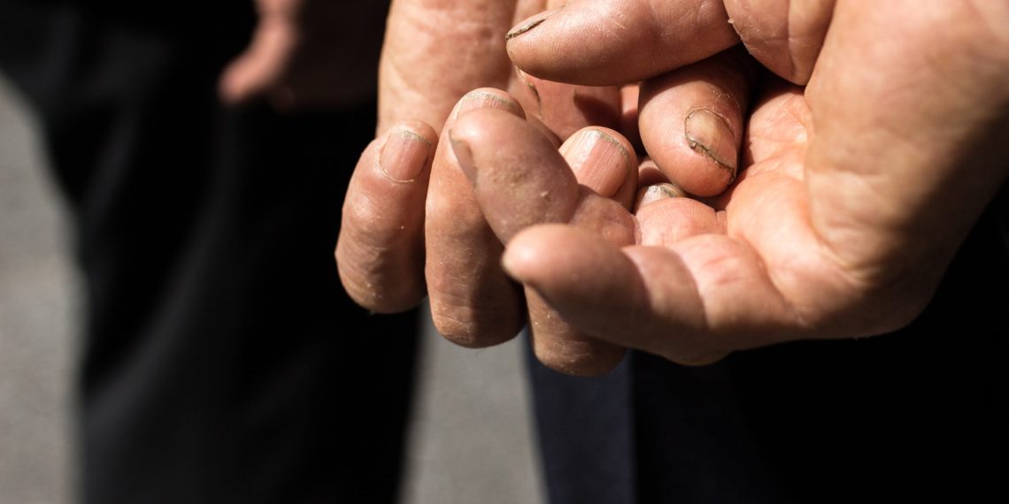 Уулуман муштум жегенден кийин башкача адам болуп өзгөрдүм