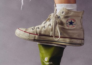 Туура эмес бут кийим кийсе варикоз пайда болот деген чынбы?