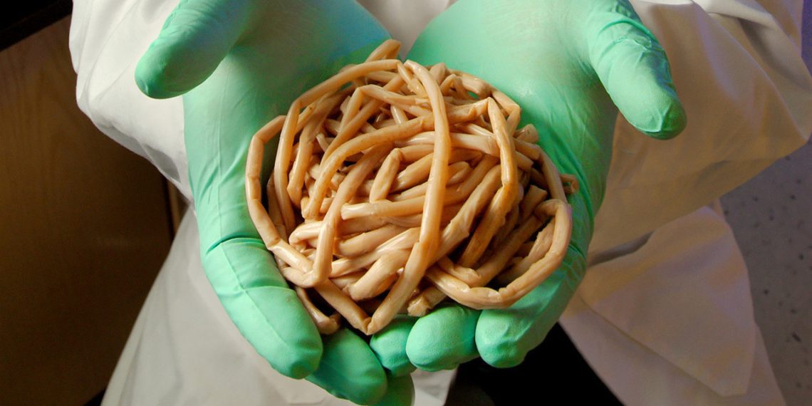 Чоң адамдын ичинде курттар бар экенин билдирген 3 белги